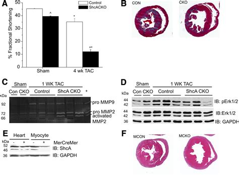 The Shca Phosphotyrosine Docking Protein Uses Distinct Mechanisms To