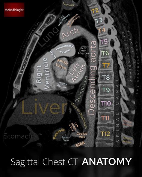 Theradiologist On Twitter Sagittal Chest Ct Anatomy