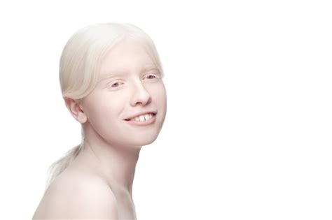 Retrato de uma linda mulher albina isolada no fundo branco do estúdio