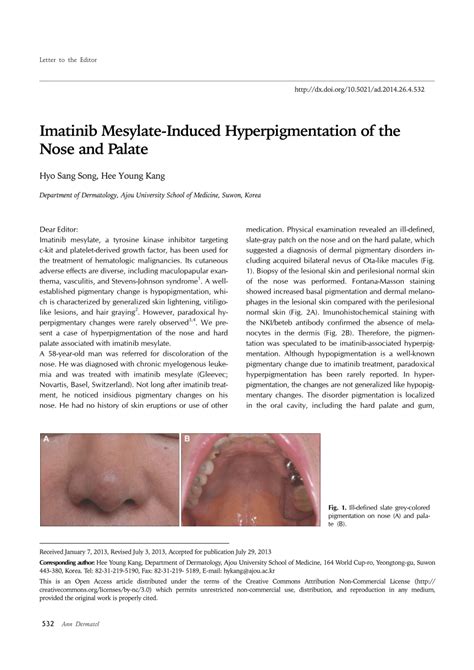 Pdf Imatinib Mesylate Induced Hyperpigmentation Of The Nose And Palate