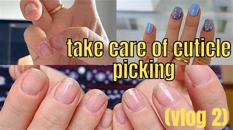 Nail Vlog 2 How To Take Care Of Cuticle Picking Youtube