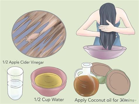 670px-Kill-Head-Lice-Step-11.jpg (670×503) | Lice remedies ...