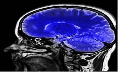 An Overview Of Modern Brain Imaging Techniques Icjs International