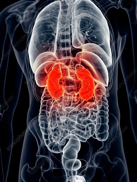 Human Kidney Pain Stock Image F0163062 Science Photo Library