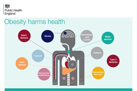 Adult Obesity Applying All Our Health Govuk