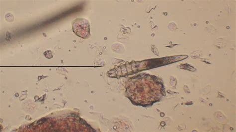 Demodectic Mange Demodex Demodex Canis Seen Under Microscope At 80