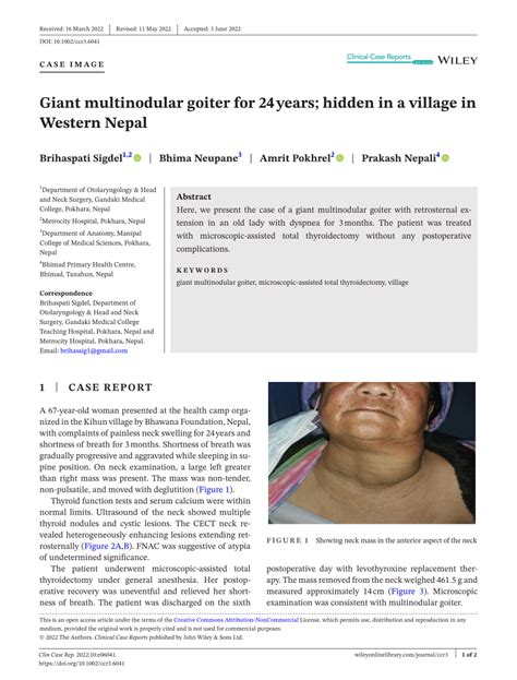 Pdf Giant Multinodular Goiter For 24 Years Hidden In A Village In