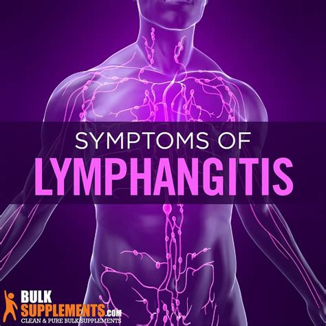 Lymphangitis Symptoms Causes And Treatment By James Denlinger Medium