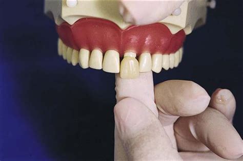 We also help cover periodontics, endodontics, oral surgery, dentures, and anesthesia. 23. Prosthodontics | Pocket Dentistry