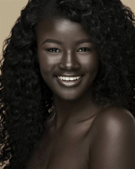 Teen Bullied Extremely Dark Skin Color Becomes Model Takes Internet Storm 3 Women Daily Magazine