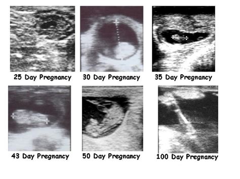 Ultrasound Pregnancy Diagnosis In Cow All About Cow Photos