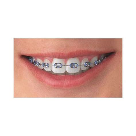 There are many options available for braces colors. Dental Orthodontic Elastic Ligatures Modules Ties For ...