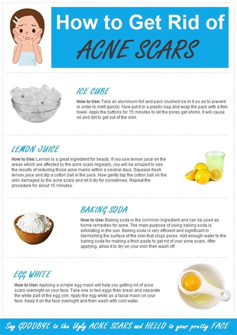 Active Home Remedies How To Get Rid Of Acne Scars Overnight