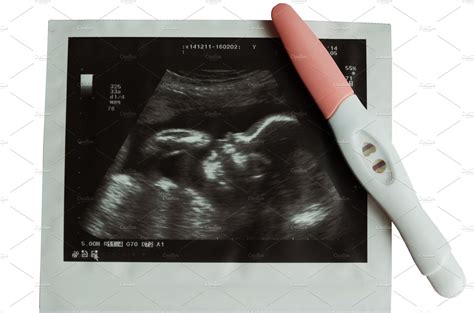 Ultrasound Picture Of Baby With Pregnancy Test High Quality Health