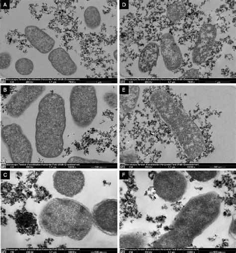 Transmission Electron Microscopy Images Of Salmonella Typhimurium Ta
