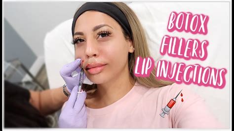 ENTIRE FACE OF BOTOX FILLER LIP INJECTIONS YouTube
