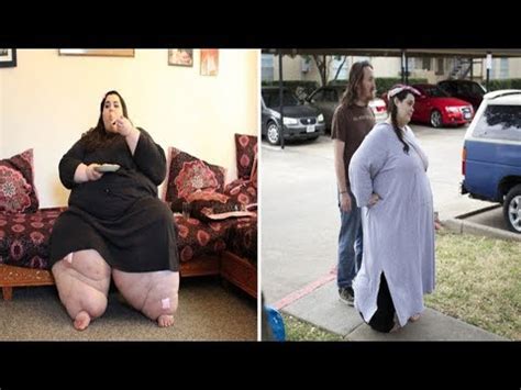 Morbidly Obese Amber Rachdi Loses Half Her Body Weight After Hitting