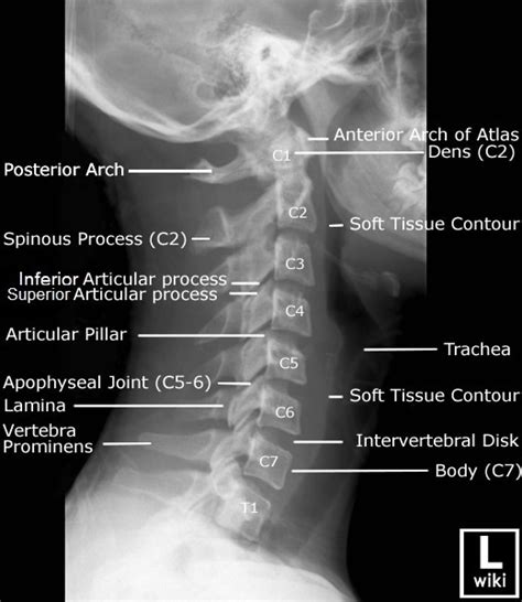 Cervical Spine Anatomy Atlantazik
