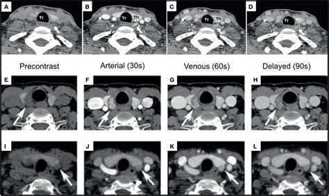 Frontiers Parathyroid Imaging Past Present And Future