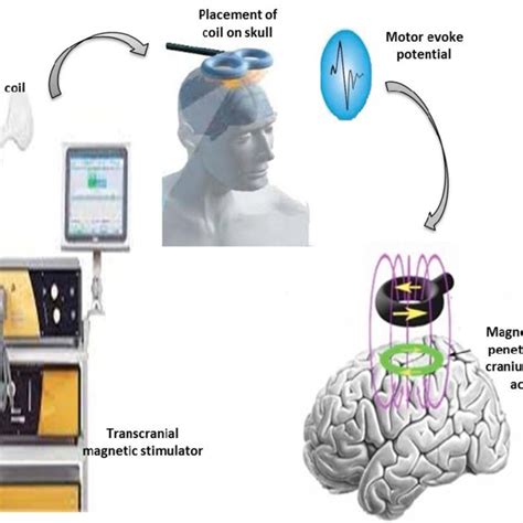 Process Of Transcranial Magnetic Stimulation Download Scientific Diagram