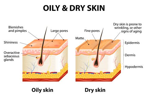 There is no single cause of dry skin. Skin Concern Detail - Dryness and Dehydration - Ultraceuticals