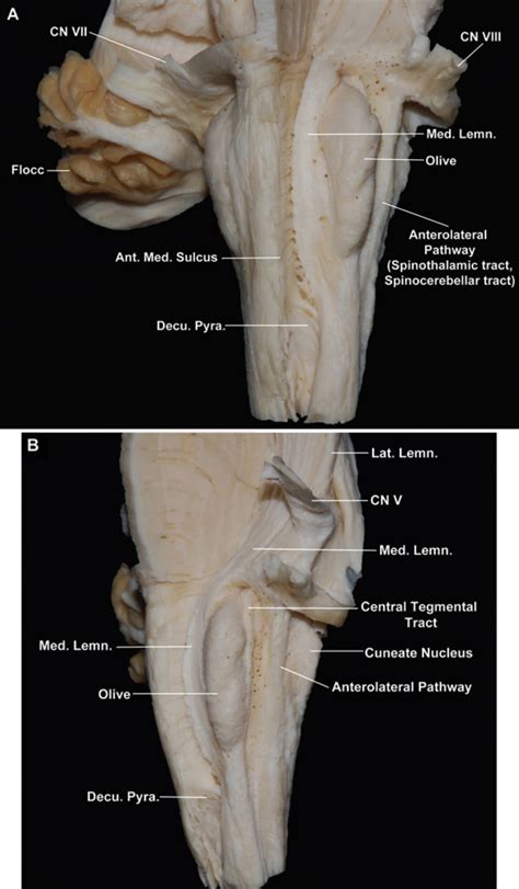 Anterolateral View Of The Medulla Oblongata Neuroanatomy The