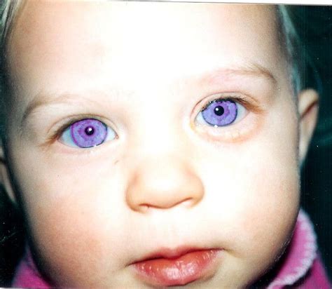 Фиолетовый Цвет Глаз У Человека Фото Telegraph
