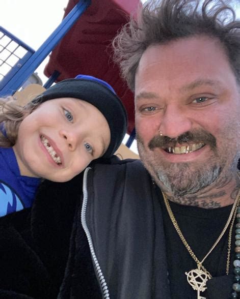 Bam Margera Says He ‘was Basically Pronounced Dead ’ Had 4 Seizures After Pneumonia News And