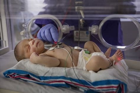 Newborn And Neonatal Care Hackensack Meridian Mountainside Medical Center