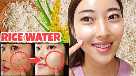 Rice Water Skincare Routine 🌾i Used Rice Water On My Face For 4 Days Before And After Result