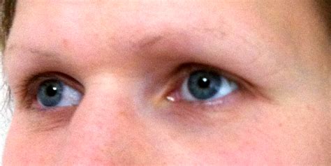 And, in case it becomes permanent, it then turns into a condition known as alopecia. Hair Loss & Thinning - Amy Packer Permanent Makeup ...