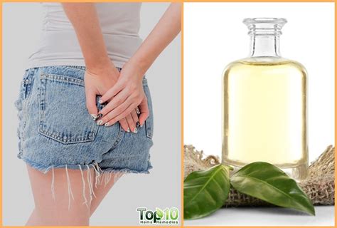 Home Remedies For Pilonidal Cysts Large Pimple At Bottom Of Tailbone