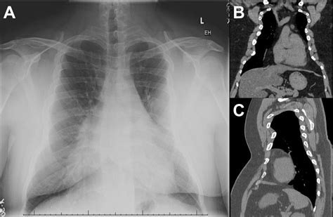 Southwest Journal Of Pulmonary Critical Care And Sleep Imaging