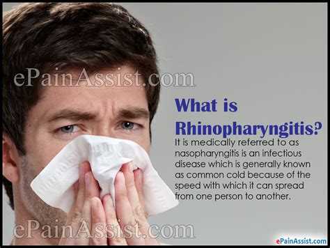 What Is Rhinopharyngitis Or Acute Coryzacausessignssymptoms
