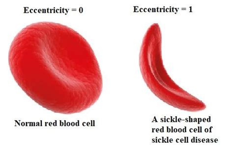 The Difference In Eccentricity For Normal Red Blood Cell And