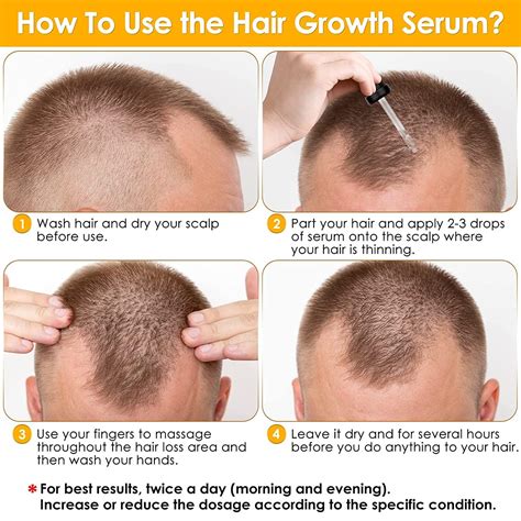 Minoxidil Hair Growth Serum Oil Biotin Hair Regrowth Treatment For