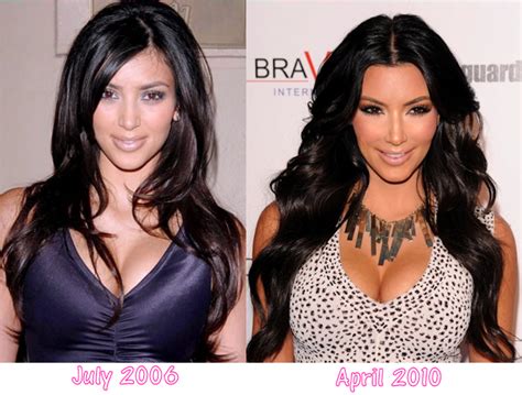 Bossmaurices Blog Photos Did Kim Kardashian Have Plastic Surgery