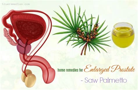57 Home Remedies For Enlarged Prostate Gland Relief
