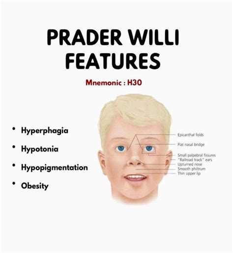Praderwilli Syndrome Features Medizzy