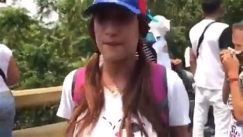 Una Venezolana Se Levantó La Remera Para Denunciar Que Le Dispararon Y