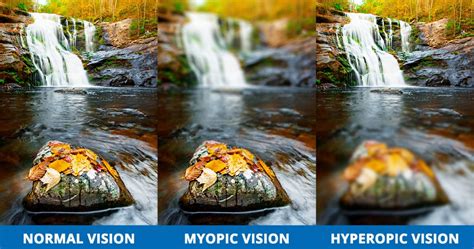 Understanding Nearsightedness, Farsightedness, Astigmatism and Presbyopia | Dr. Taylor - The Eye ...