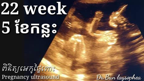ពិនិត្យឣេកូផ្ទៃពោះ 5ខែ កន្លះ Pregnancy Ultrasound 22 Week By Drbun