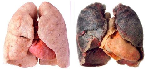 Is Smokers Lungs A Lie ECHEMI