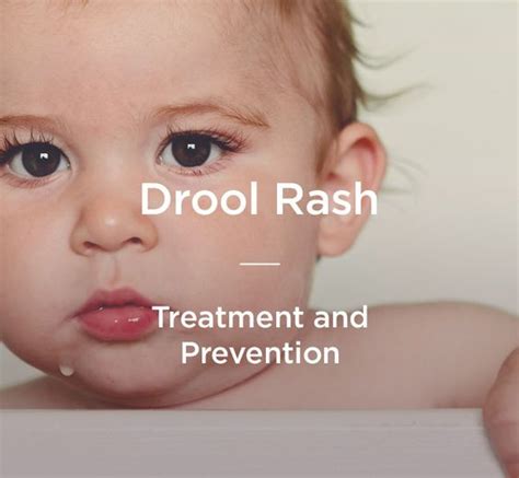 How Best To Treat And Prevent A Drool Rash Health Babies And Parenting