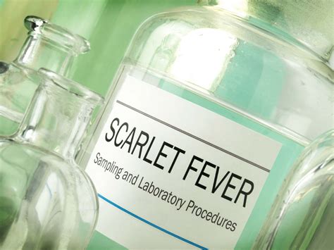 Nine Confirmed Or Suspected Cases Of Scarlet Fever This Year Guernsey