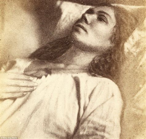 Haunting Pictures Show Women Being Treated For Hysteria In The 1870s