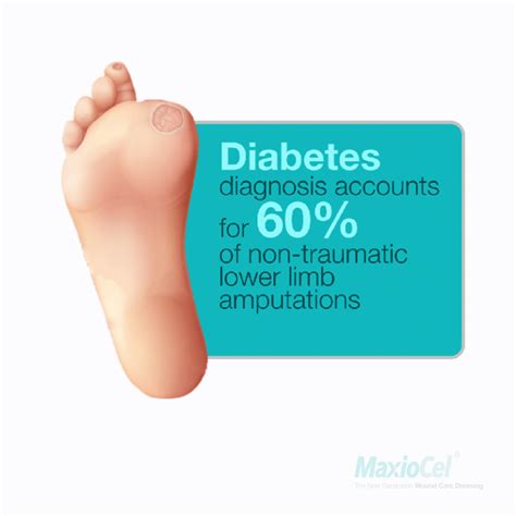 Diabetic Foot Ulcers Risk Factors Symptoms Treatment