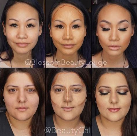 Before And After Photos Of Face Contouring