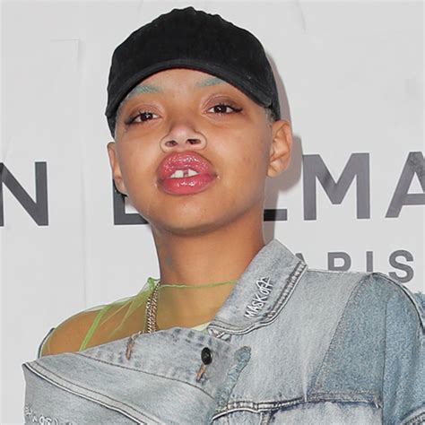 Model Slick Woods Says Her Life Was Saved After Suffering Seizure