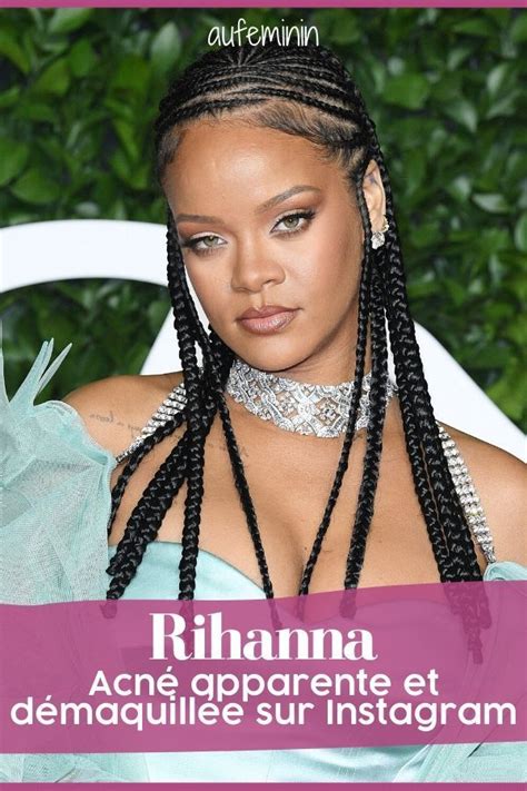 Acné Apparente Et Démaquillée Rihanna Sexpose Au Naturel Sur